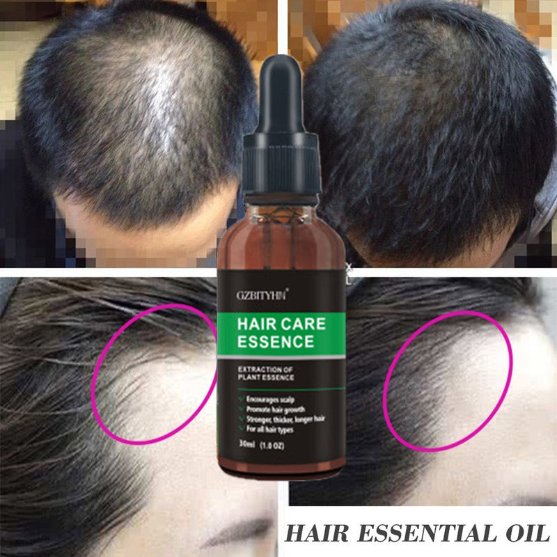 Hair Growth Essential Oil